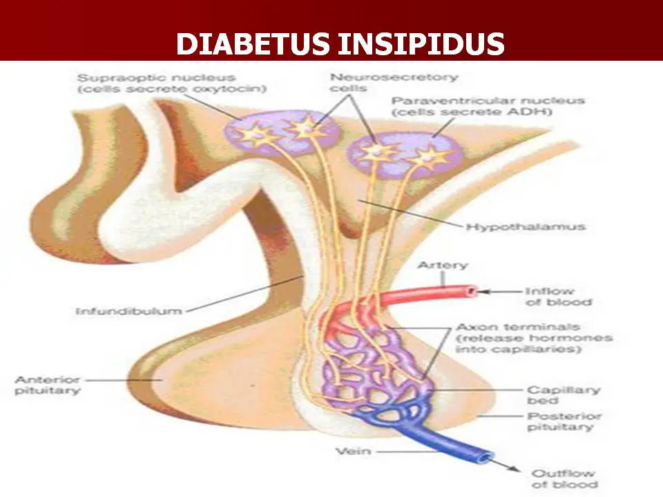diabetes insipidus labor lexikon