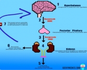 Diabetes Insipidus (8)