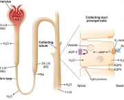 Diabetes Insipidus (10)