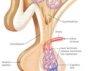 Diabetes Insipidus (13)