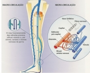 doenca-vascular-periferica-18