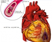 doenca-vascular-periferica-26