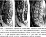 doencas-que-podem-atingir-a-medula-ossea-2