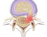 doencas-que-podem-atingir-a-medula-ossea-4