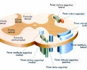 exercicios-para-afasia-7