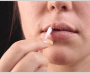 tudo-sobre-a-herpes-labial-10