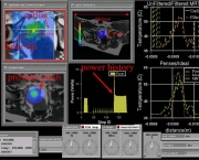 laser-vivo-1