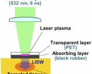 laser-vivo-10