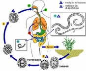 ascaridiase