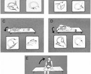 neuropatia-periferica-tratamento-11