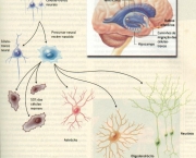 o-que-e-esclerose-lateral-amiotrofica-15