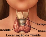 hipotireoidismo-1