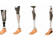 O Que é Prótese Ortopédica (14)