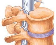 o-transplante-e-a-doacao-de-medula-ossea-6