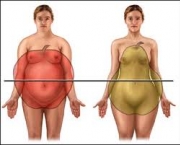 obesidade-morbida-4