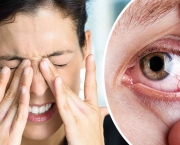 Causas do Olho Seco (7)