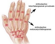 Os Princípios Da Artrite (6)