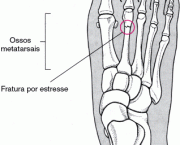 ossos-dos-pes-11