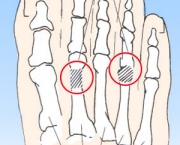 ossos-dos-pes-7