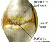 joelho-11