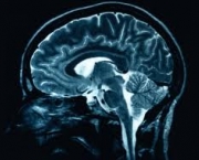 ouvir-musica-classica-aumenta-a-capacidade-cerebral-6