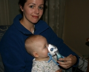 Pneumonia Infantil (13)