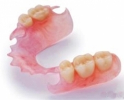Prótese Dentária de Silicone Fixa (2)