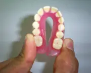 Prótese Dentária de Silicone Fixa (4)
