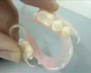 Prótese Dentária de Silicone Fixa (6)
