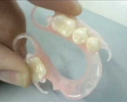 Prótese Dentária de Silicone Fixa (6)