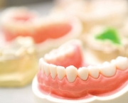 Prótese Dentária de Silicone Fixa (11)