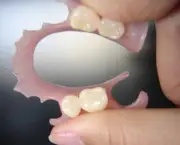 Prótese Dentária de Silicone Fixa (13)