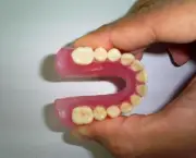 Prótese Dentária de Silicone Fixa (15)