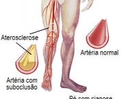 quais-desvantagens-do-colesterol-1