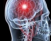 quanto-tempo-pode-durar-um-dano-cerebral-5