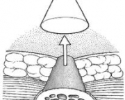 riscos-lesao-isquemica-6