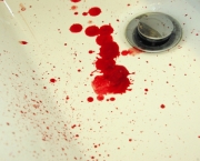 Sintomas Do Sangue Grosso (1).jpg