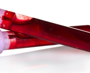 Sintomas Do Sangue Grosso (2).jpg