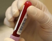 Sintomas Do Sangue Grosso (4).jpg