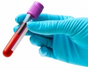 Sintomas Do Sangue Grosso (13).jpg