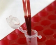 Sintomas Do Sangue Grosso (14).jpg