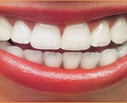 sorriso-colgate-11