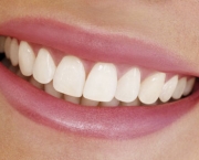 sorriso-colgate-12