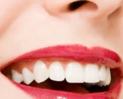 sorriso-colgate-13