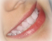 sorriso-colgate-14