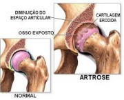 termos-chave-da-sindrome-de-shy-drager-3