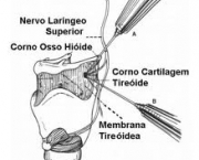 termos-importante-4