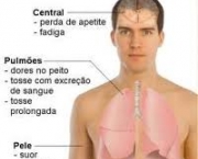 tuberculose-3