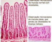 tudo-sobre-intolerancia-a-gluten-1