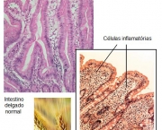 tudo-sobre-intolerancia-a-gluten-3